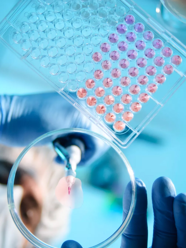Échantillons de test en laboratoire sur une assiette